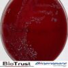 ANAEROBE CDC BLOOD AGAR BIOPREPARE