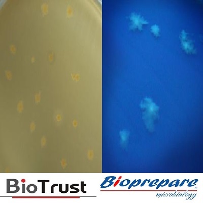CLOSTRIDIUM DIFFICILE AGAR CCEY (BRAZIE’S) BIOPREPARE